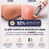 QUITA DUREZAS RECARGABLE